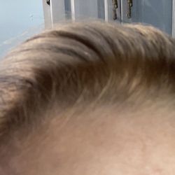 Ya no puedo hacerme el cabello para atrás porque se ve esta indiferencia ahí!!