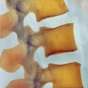 Budincich Chiropractic Clinic - Spine in water - Chiropractors Near Me - Pasadena, California
