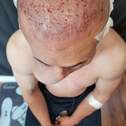 Lux Medical Spa