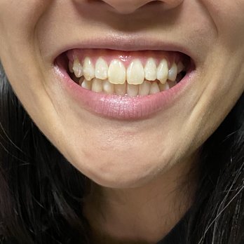 Tooth Spa Dentistry - February 2022 - General Dentistry Near Me - Lincoln, California