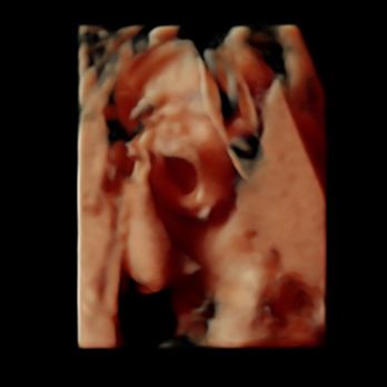 Prenatal Universe - Yawn! - Diagnostic Imaging Near Me - Tacoma, Washington Prenatal Universe - Yawn! - Diagnostic Imaging Near Me - Tacoma, Washington