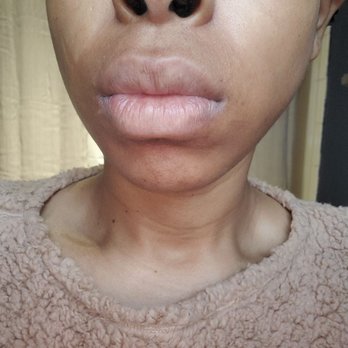 MineYourBeezWax - My upper lip after being waved by London. - Hair Extensions Near Me - Ontario, California