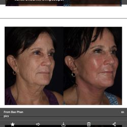 Bao L Phan, MD - Hawaii Plastic Surgery Institute