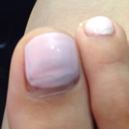 You can see that the area close to cuticle has less coverage. Coverage is not even.