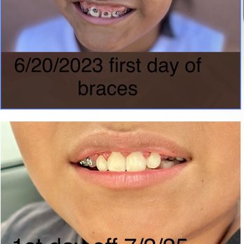 Las Vegas Braces - Orthodontists Near Me - Las Vegas, Nevada Las Vegas Braces - Orthodontists Near Me - Las Vegas, Nevada