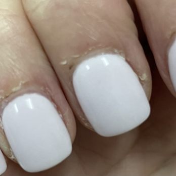 Creative Touch Nails & Day Spa - Terrible hands now! - Nail Salons Near Me - Elkhart, Indiana