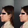 Photo of Profiles Beverly Hills