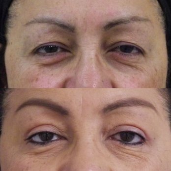 Julie Edween, DO - Cosmetic Surgeons Near Me - Beverly Hills, California Julie Edween, DO - Cosmetic Surgeons Near Me - Beverly Hills, California