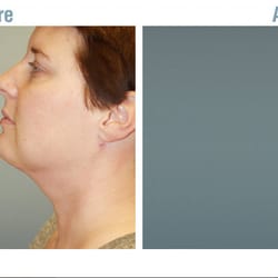 Advanced Therapeutics - Cosmetic Surgery and Rejuvenation