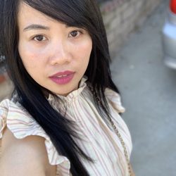 Beauty Perfect Medical Aesthetics - After PRP no foundation or powder just lipstick