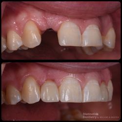 Distinctive Dentistry by Mullens & Nguyen
