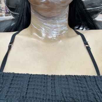 Laser Cliniqúe | San Diego's Premier Medical Spa - Getting Morpheus8 done on my neck - Laser Hair Removal Near Me - San Diego, California Laser Cliniqúe | San Diego's Premier Medical Spa - Getting Morpheus8 done on my neck - Laser Hair Removal Near Me - San Diego, California