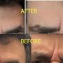 Photo of Mila Beauty Injections