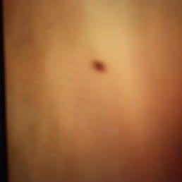 This is the pic of one of the bed bugs on my husband's pillow then more started appearing. This is the pic of one of the bed bugs on my husband's pillow then more started appearing.