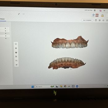 Linh M Cao-Chan,DDS - Our digital oral scanner can capture digital images of your teeth, similar to taking dental impressions! - Cosmetic Dentists Near Me - El Cerrito, California Linh M Cao-Chan,DDS - Our digital oral scanner can capture digital images of your teeth, similar to taking dental impressions! - Cosmetic Dentists Near Me - El Cerrito, California