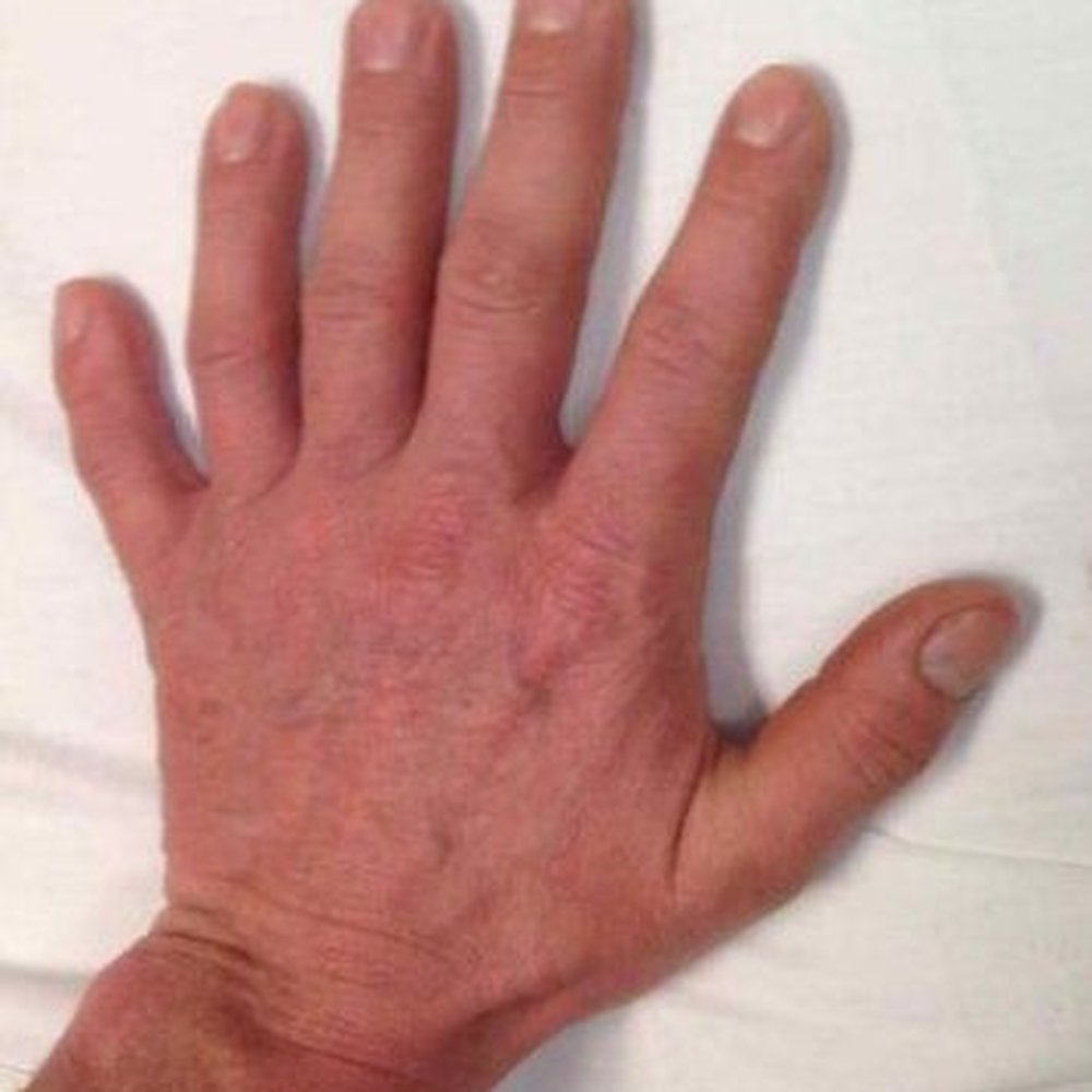 Husband's hand. Husband's hand.