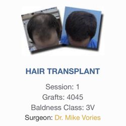 Carolina Hair Surgery