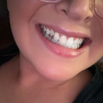 Tru Orthodontics - Springfield - Straighter teeth - Orthodontists Near Me - West Springfield, Virginia Tru Orthodontics - Springfield - Straighter teeth - Orthodontists Near Me - West Springfield, Virginia