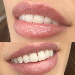 TennSkin - Lip Blushing