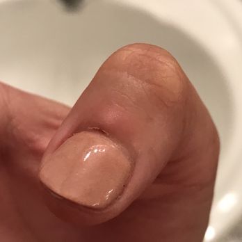 Blume Beauty Bar - Cuticle on my right thumb. - Day Spas Near Me - Prairieville, Louisiana