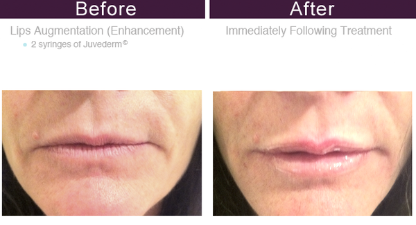 You Rejuvenated by null