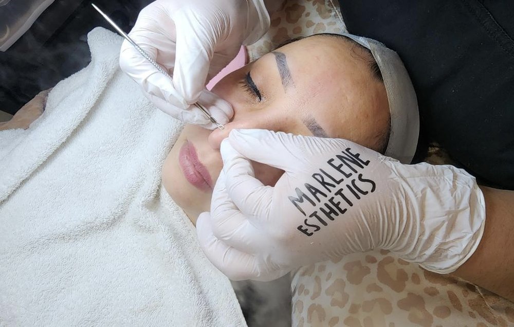 Marlene Esthetics Logo