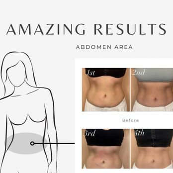 Beautiful Body Recovery - Day Spas Near Me - Georgetown, Texas Beautiful Body Recovery - Day Spas Near Me - Georgetown, Texas