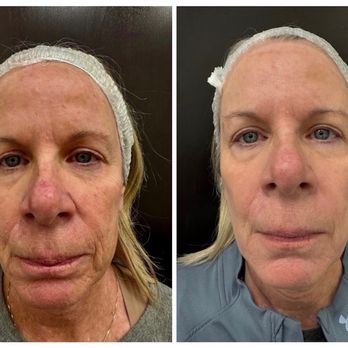 Skin Deep By Victoria - Skin Care Near Me - Goodyear, Arizona Skin Deep By Victoria - Skin Care Near Me - Goodyear, Arizona
