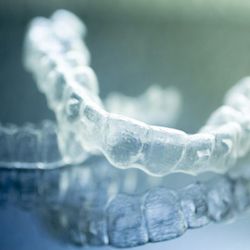 Sakowitz Smiles Orthodontics - Lake Nona - Invisalign Clear "Braces"