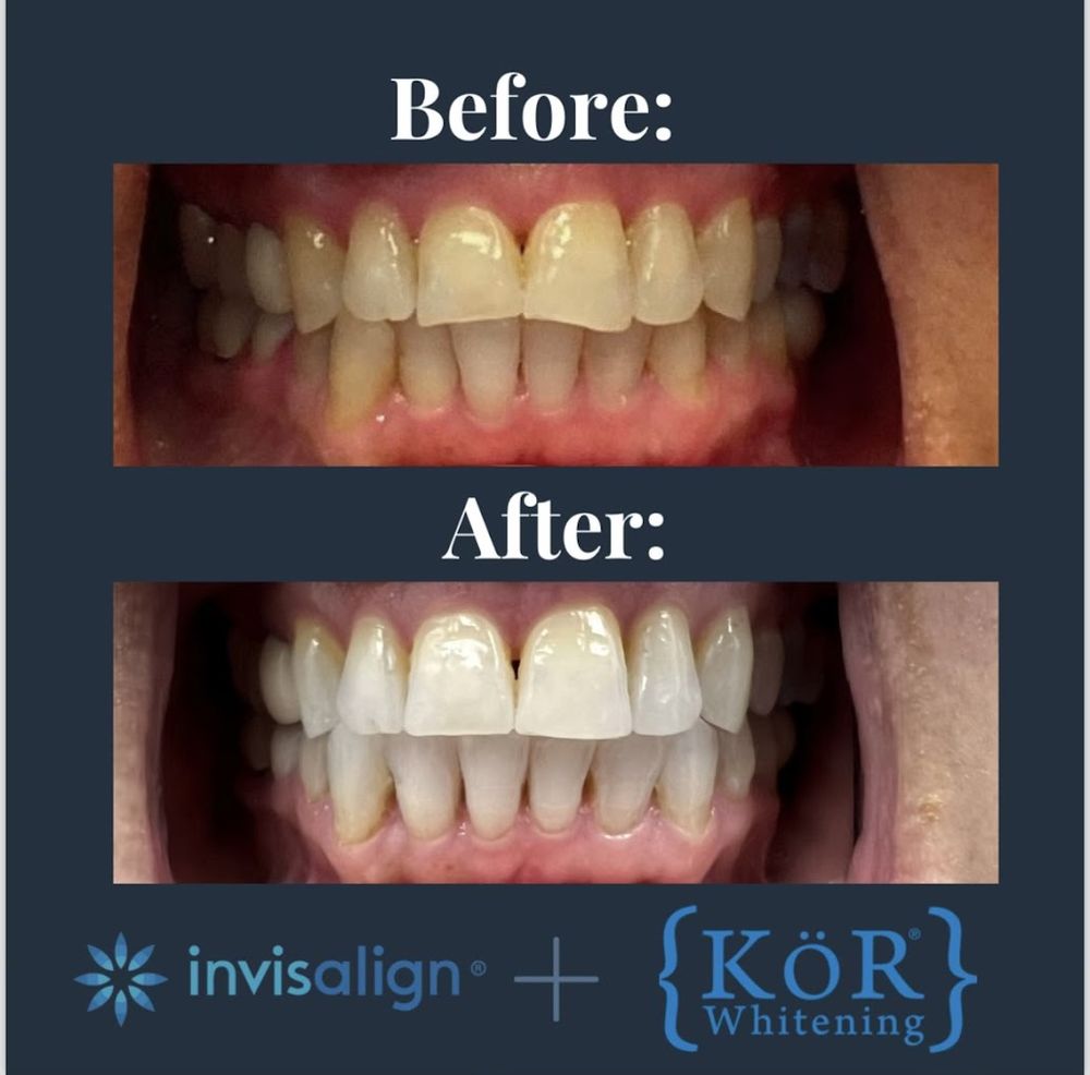 GLENPOOL DENTIST ECLIPSE SMILES Updated September 2024 11 Photos