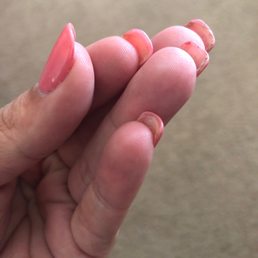 This is what it looks like within the week of having them. This is what it looks like within the week of having them.