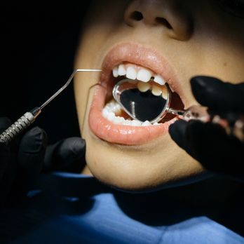 Russell Tritapoe, DDS - Russell Tritapoe DDS
Child Dentistry
Dentist
Teeth
Teeth Cleaning
Tooth Repairs - General Dentistry Near Me - Fort Ashby, West Virginia Russell Tritapoe, DDS - Russell Tritapoe DDS
Child Dentistry
Dentist
Teeth
Teeth Cleaning
Tooth Repairs - General Dentistry Near Me - Fort Ashby, West Virginia