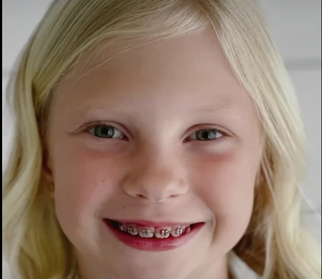 Creating Beautiful Smiles - Our orthodontist and friendly, welcoming team use digital X-rays and quality materials to align the teeth of both kids and adults.
