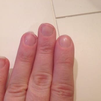 La Perfection Nails - My nails a few days after breaking due to poor filing. - Nail Salons Near Me - Middlesex, New Jersey