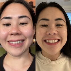 Orange Acupuncture Center - Full recovery