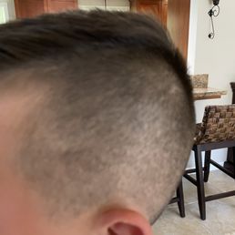 Terrible haircut uneven bald spots Terrible haircut uneven bald spots
