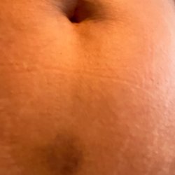 Healing Zone Acupuncture Clinic -Highland - Lower abdomen