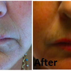 Dr. Bawa & Associates - © Dr. Bawa & Associates
Results may vary.