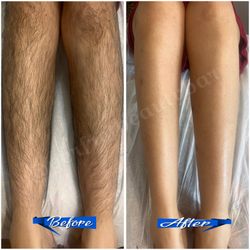 Perfect Beauty Bar - Legs waxing done at the perfect beauty bar!!!