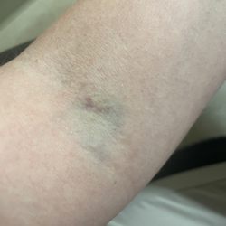 Quest Diagnostics - Two days later