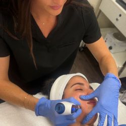 Gravity MedSpa - Microneedling
