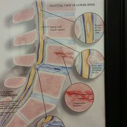 Neuroscience Center of Ventura County - Informative diagrams