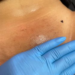 After sugar-wax (ask for your complimentary tattoo)