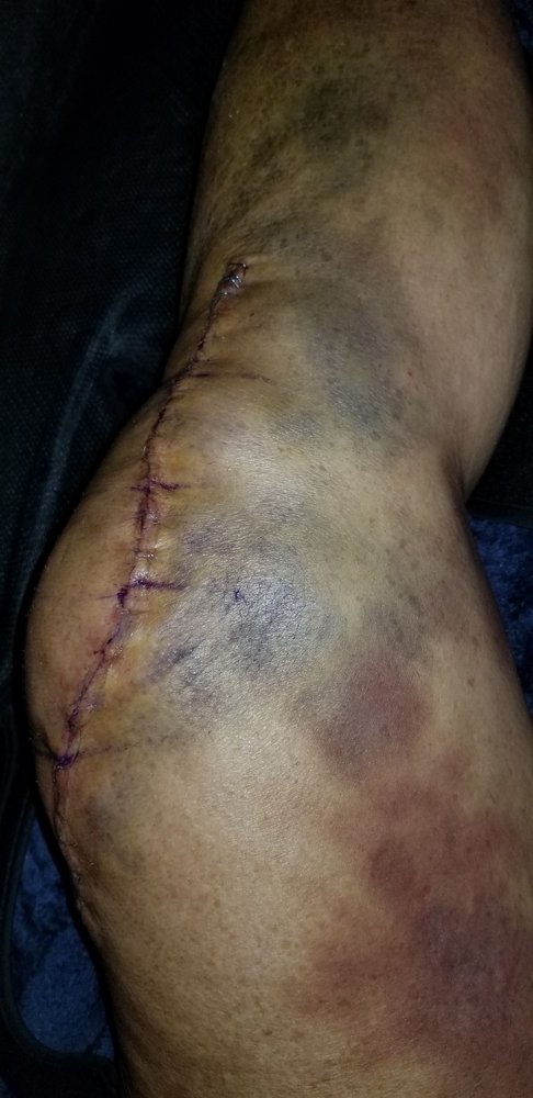 Rothman Orthopaedics - patient advocate in Philadelphia, PA