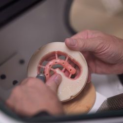 Forever Smiles Implant Center - Custom milled teeth, designed by Forever Smiles.
