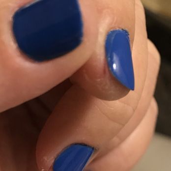 Nj Nails Spa - Hard to see, but these are a few of the fingers where the skin was excitedly filed away. (look at the lines) - Waxing Near Me - Novato, California Nj Nails Spa - Hard to see, but these are a few of the fingers where the skin was excitedly filed away. (look at the lines) - Waxing Near Me - Novato, California