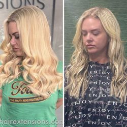 HairDocTK - Before v After