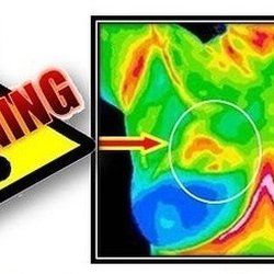 Body and Soul Medical and Holisitic Spa - We offer Breast Thermography DITI image can detect cancer cells 8 years before mammography