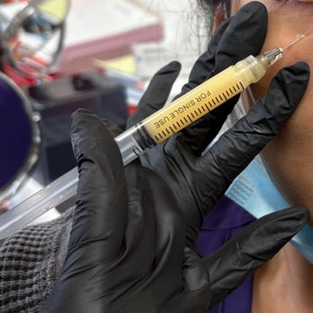 Tiara Aesthetics - EZ PRF gel injection - Medical Spas Near Me - Los Angeles, California Tiara Aesthetics - EZ PRF gel injection - Medical Spas Near Me - Los Angeles, California