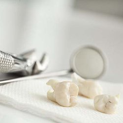 Greenbrier Family Dental - Root canals